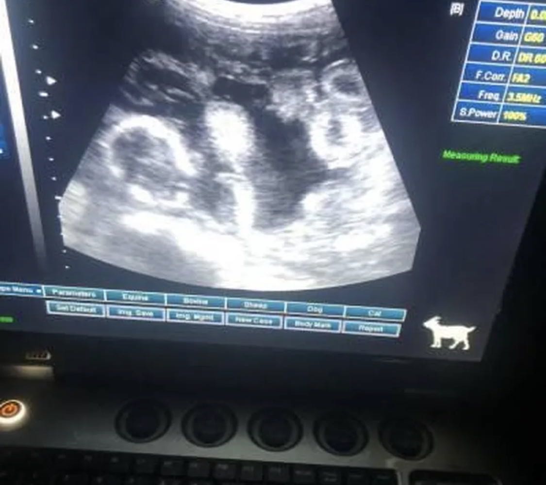 سونار للغنم والماعز