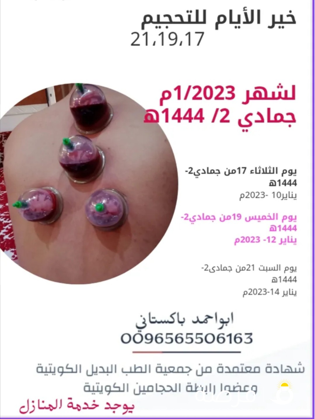 خير ايام الحجامة 17،19،21