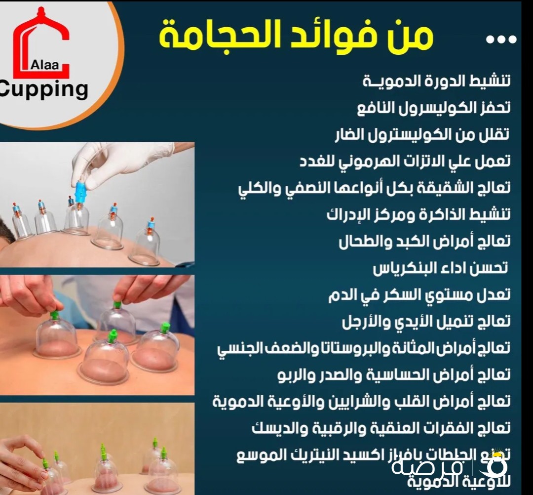 حجامه الكويت ابو عمر الصديق
