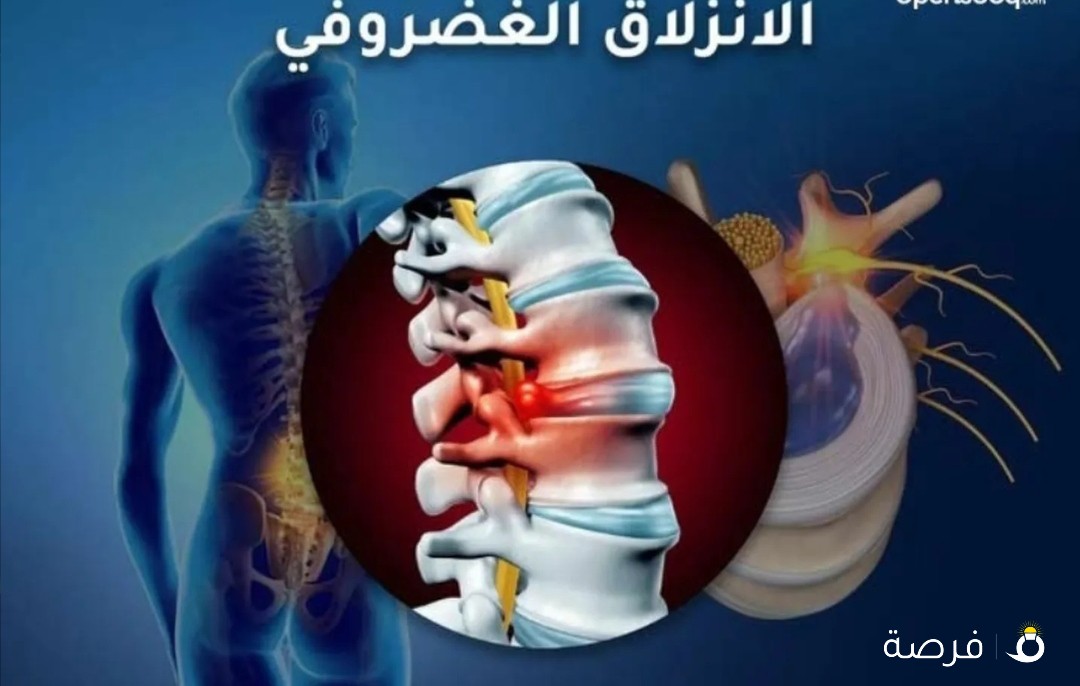مساج تاهيل