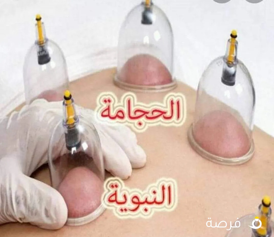 حجامة ابو عمر