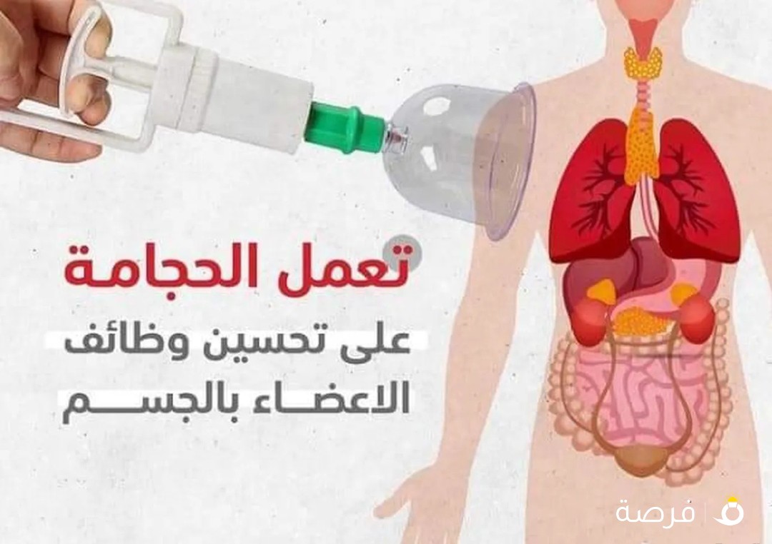 افضل مركز في الكويت معتمد للعلاج بالحجامة والطب البديل
