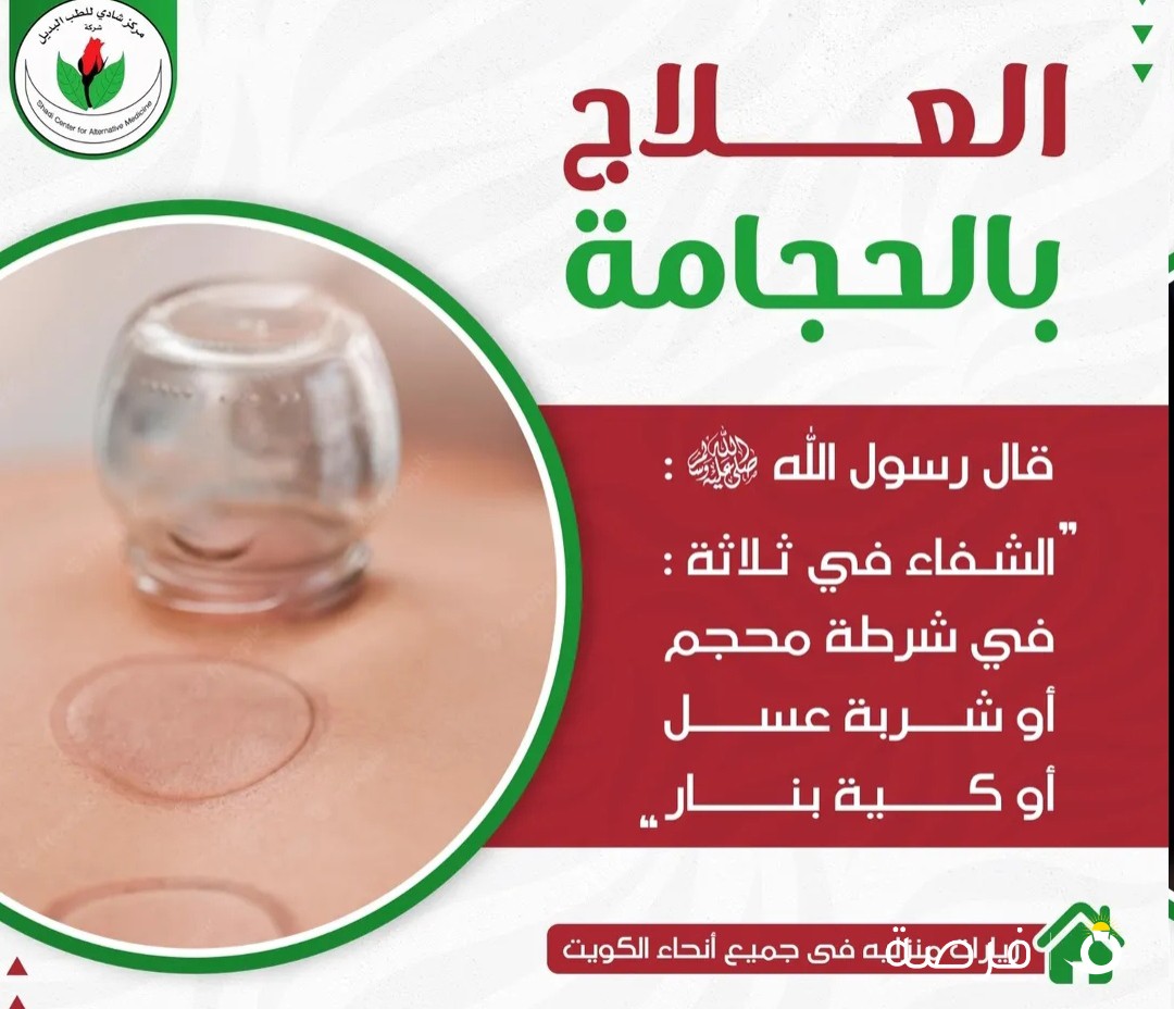 مركز ال شادي للخدمات الطبية /

للحجز والاستفسار - 50407776/66625123

عرض خاص

حجامة + شمع تنظيف الاذن

فقط ب 8 د.ك

مركز معتمد حاصل على شهادة الايزو

يوجد قسم اعشاب طبيعية لجميع الامراض

حجامه الكويت

خدمه منازل جميع مناطق الكويت

ما هي الأمراض التي تعالجها الحجامة؟

آلام الرقبة والركبة وآلام الظهر المزمنة.

التهاب المفاصل الروماتويدي وخدر الأطراف.

الأمراض الجلدية مثل حب الشباب.

الانتعاش الرياضي و العجز الحركي.

الصداع المزمن او النصفي “الشقيقة.

مشاكل الضغط المرتفع والغدة الدرقية.

تورم الساقين والدوالي وارتفاع الكوليسترول.

الضعف العام والإرهاق وارتفاع درجة الحرارة.

ما هي فوائد العلاج بالحجامة؟

انستغرام :

@hendawy850

للتواصل ؛